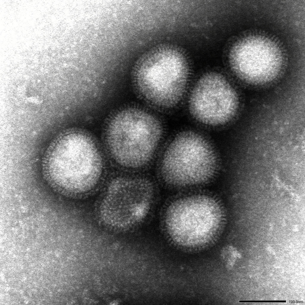 H7N9型、香港で初の感染者 鳥インフル、女性重体