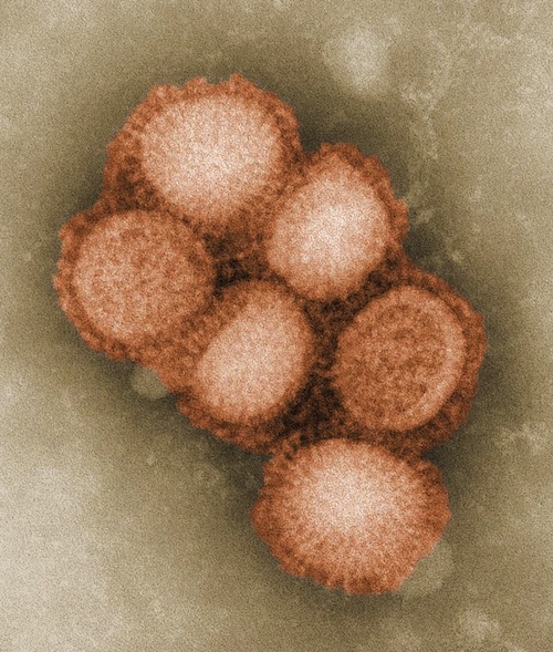 47NEWS > 共同ニュース > インフルでも「タミフル」効かず 耐性ウイルス検出 6人確認
