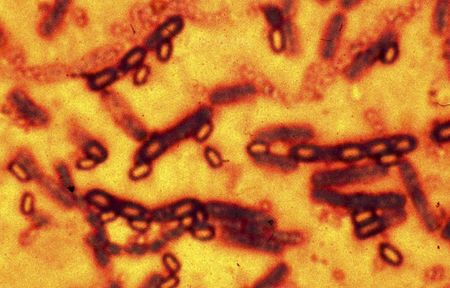 米CDC職員75人 炭疽菌に接触の恐れ