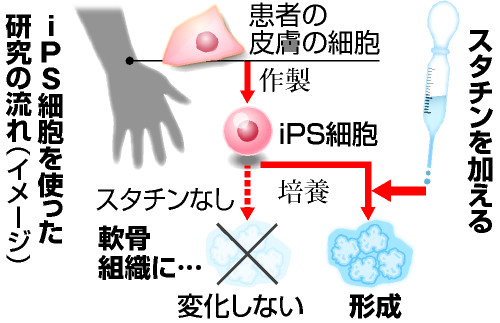 iPS細胞使えば薬・治療もテーラーメード！その人の病態・症状に合わせて開発