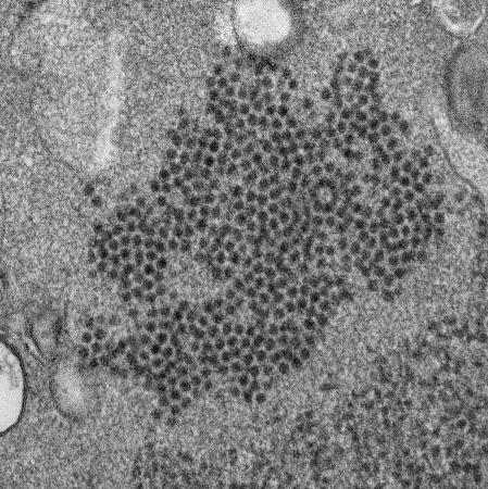 子どもに原因不明のまひ せきの後に発症、国が実態調査