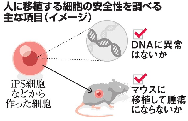 iPS移植に安全基準、厚労省が研究班 2015年11月17日 16時54分