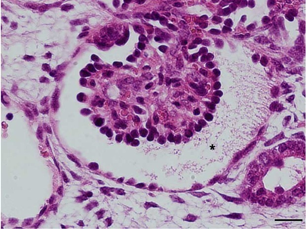 iPS細胞:マウスに移植した腎臓組織の成長成功 熊本大