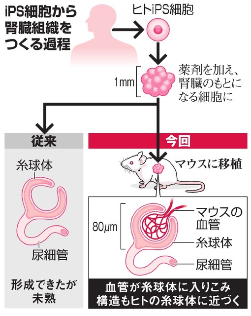 マウス移植で血管つながる＝ヒトｉＰＳから腎臓組織―将来は臨床応用・熊本大など[時事]