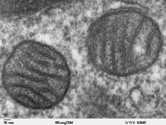 難病「ミトコンドリア病」に効用示す物質発見 東北大が治験へ