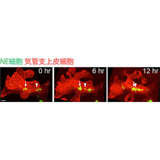 はって動く肺細胞を撮影 理研、がん転移と関連か