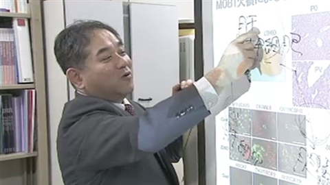 「イベルメクチン」が胆管がん抑制