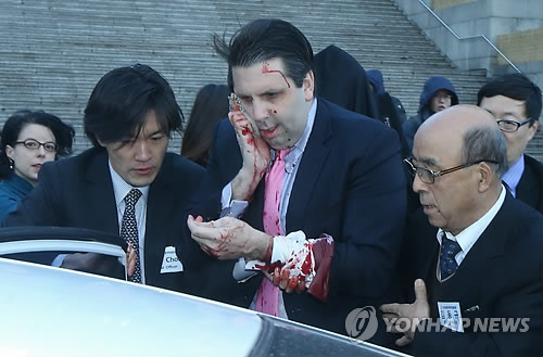 韓国、ＭＥＲＳが正式終息
