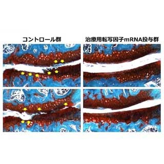 遺伝子で進行抑制 東大がマウス実験、新たな治療方法に道