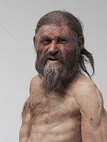 「アイスマン」にもピロリ菌=5300年前の中年ミイラ-胃潰瘍かは不明