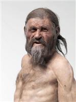 アイスマン、ピロリ菌感染していた 5300年前 胃炎に悩む?