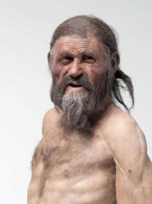 病原たんぱく、血液で全身へ=ピロリ菌、胃がん患者で発見—京大など