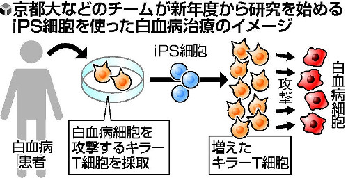 白血病治療に 京大、免疫細胞作製へ