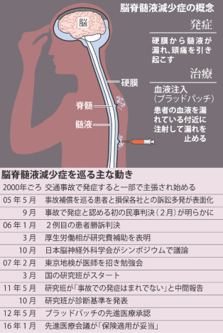 髄液漏れ治療法、保険適用へ 患者ら悲願達成 医学研究前進の１０年