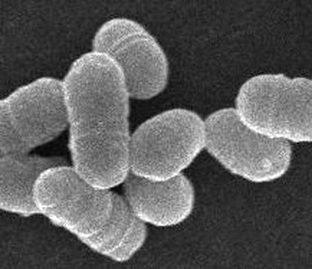 虫歯菌、脳出血に関与 新たな予防法に期待