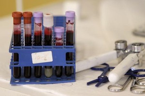 米FDA、ジカ熱流行地での献血中止を呼びかけ