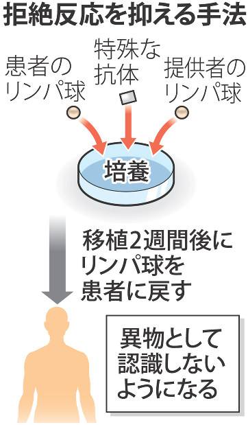 移植後、免疫抑制剤いらず 患者・提供者の細胞投与 北大など