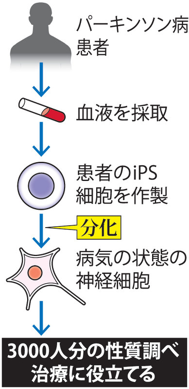 パーキンソン病iPSバンク設立へ…順大・慶大が新手法