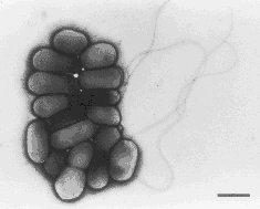堺O157食中毒で４人目死者、20年前小１の女性 2016年03月31日