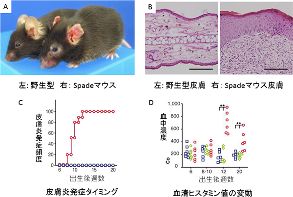 アトピー性皮膚炎、原因遺伝子を発見…理研など