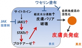 理研、アトピー性皮膚炎の原因遺伝子の解明